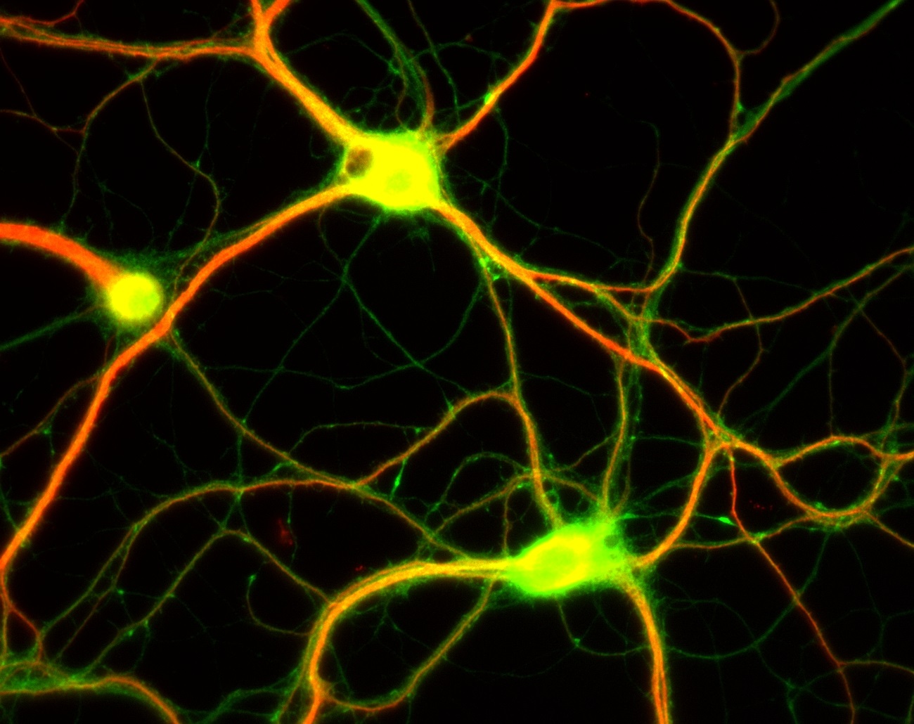 Neurons connect and “talk” to each other by sending chemical messengers called neurotransmitters. While you might text to connect to your friends, neurons pass their messages through synapses, which are tiny gaps between neurons. It’s not uncommon for one neuron to have a thousand synapses. Altogether there are about 100 trillion synapses in the brain—about the same as the number of cells in your body! ("Photo via Dieter Brandner; Ginger Withers)