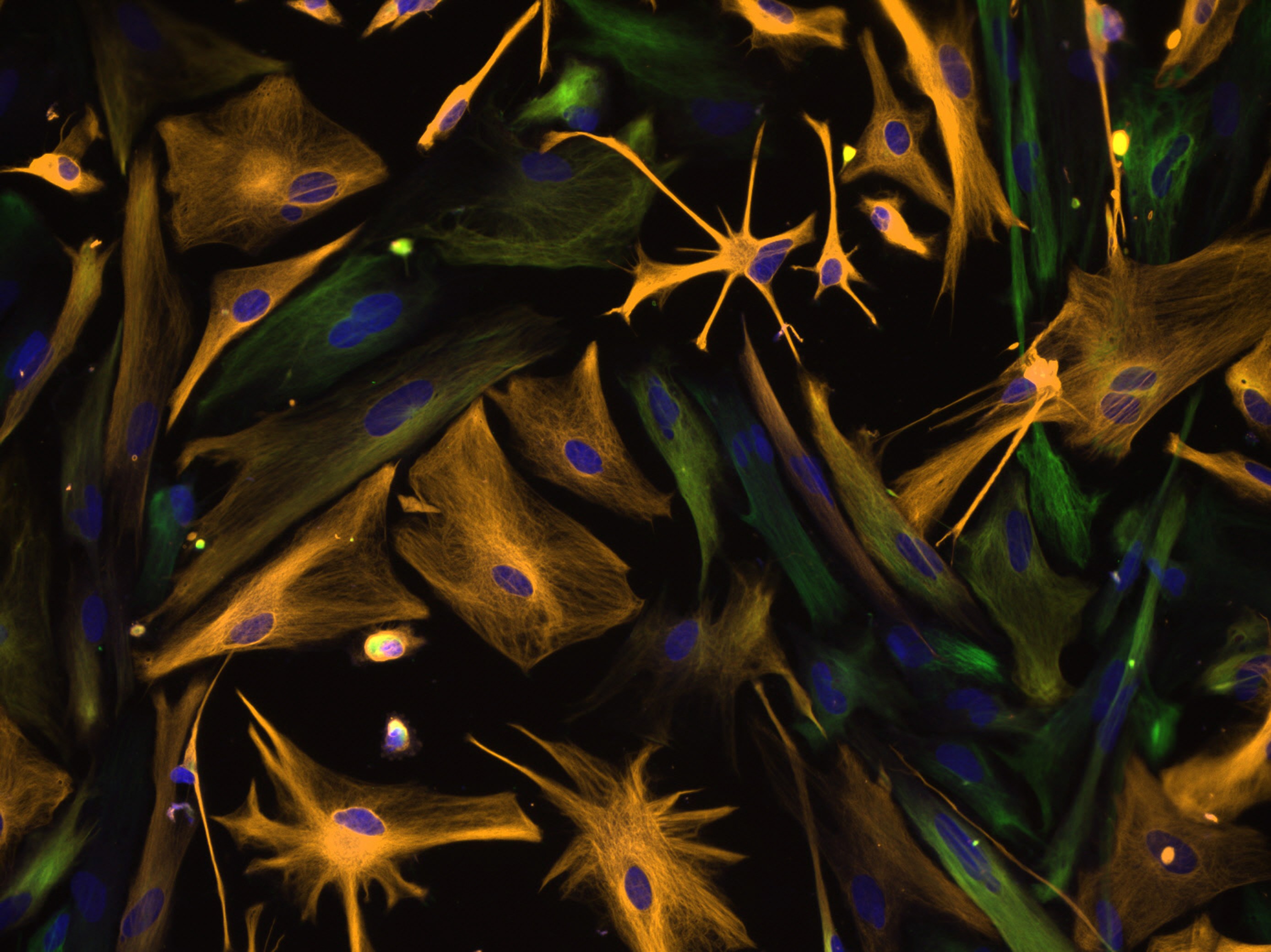 These star-shaped, orange-colored “astrocytes” are special kinds of cells that provide blood to the brain and help neurons stay healthy. The nucleus of each cell is shown in blue. The green cells are “neural progenitor cells,” which can grow into astrocytes. This image looks like an abstract painting, but it is actually a photo taken with a microscope. The scientists, who were studying and growing these cells in a laboratory, stained the cell parts different colors. (Photo via NINDS) 