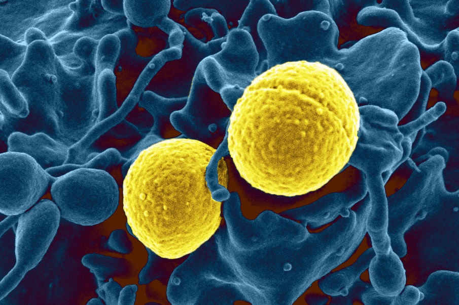 Cell-on-cell battle! Your white blood cells can sense tiny microbial invaders in your bloodstream and will literally chase them down. Here, a white blood cell (shown in blue and magnified about 50,000 times its actual size) attacks and devours the dangerous MRSA bacteria (shown in yellow). (Image via NIAID) 