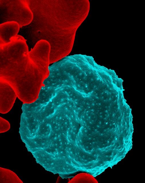 Seen through an electron microscope, a malaria microbe invades a red blood cell. (Image via NIAID) 