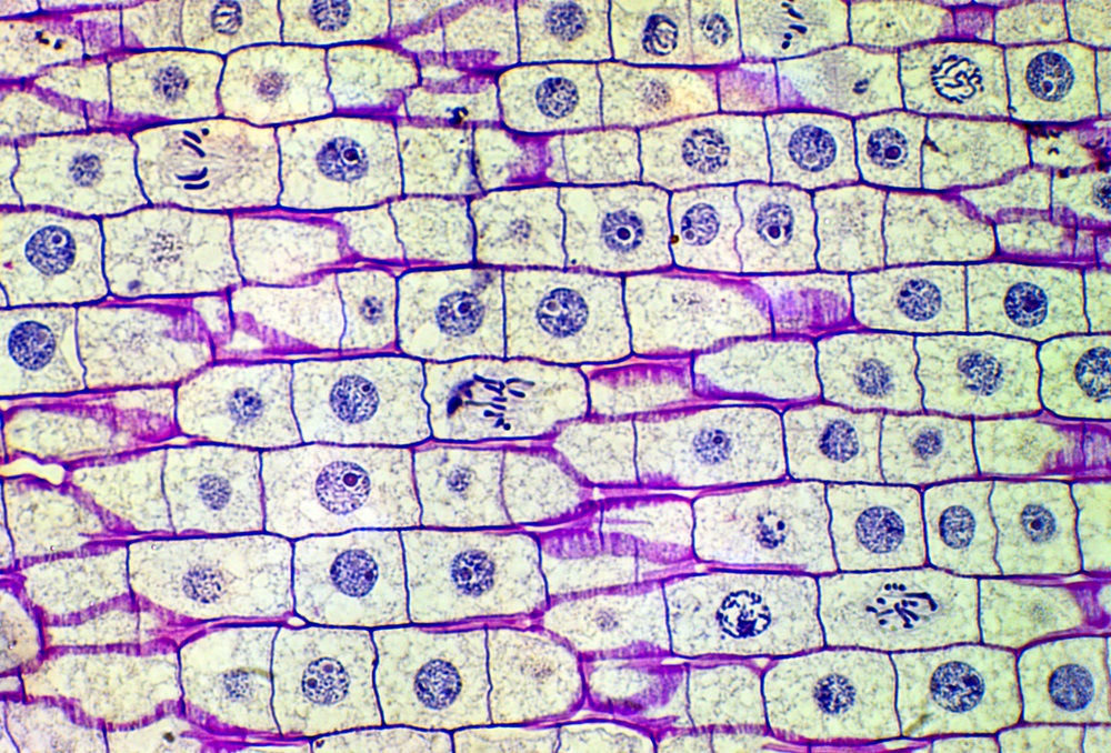 This is part of an onion plant magnified about 40 times so you can see individual cells. Why do some of the cells have stringy parts instead of round nuclei? Those cells are in different stages of “mitosis,” the process of making a new cell. During mitosis, the membrane of the nucleus breaks down, freeing the DNA to make a copy of itself. Those stringy parts are bunches of DNA called chromosomes. Once the DNA has been duplicated, the cell splits, creating two new cells with identical parts. (Carolina K. Smith, MD/ Shutterstock) 