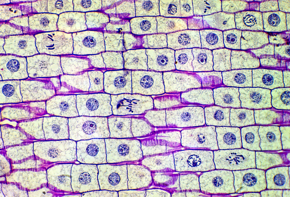 This is part of an onion plant magnified about 40 times so you can see individual cells. Why do some of the cells have stringy parts instead of round nuclei? Those cells are in different stages of “mitosis,” the process of making a new cell. During mitosis, the membrane of the nucleus breaks down, freeing the DNA to make a copy of itself. Those stringy parts are bunches of DNA called chromosomes. Once the DNA has been duplicated, the cell splits, creating two new cells with identical parts. (Carolina K. Smith, MD/ Shutterstock)