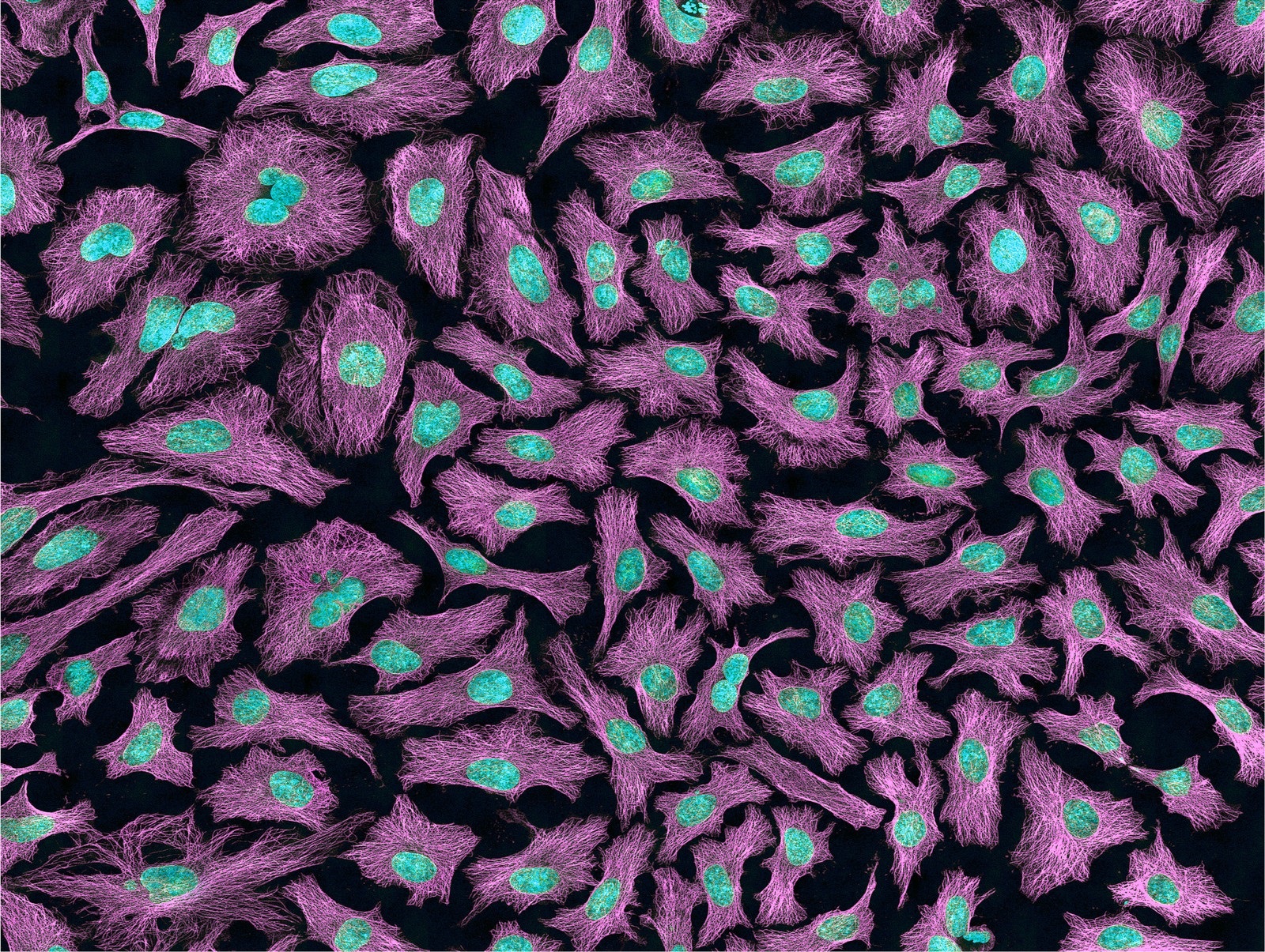 These cells come from the human body and are being used to study cancer and other diseases. The nucleus and DNA inside each cell look blue. The purple shows “microtubules,” which are cell parts that help cells keep their shape and serve as “roads” along which other cell parts travel. This image was taken using a multiphoton fluorescence microscope. (Photo via NIH) 