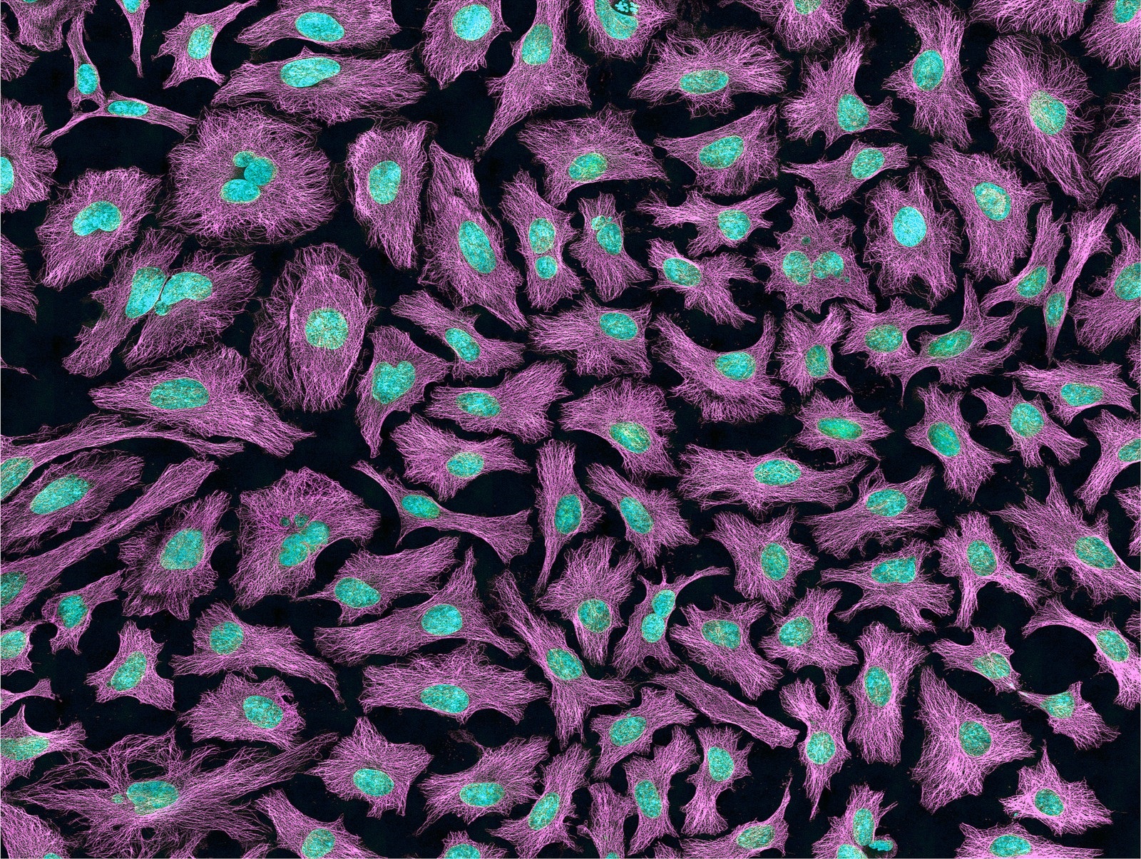 These cells come from the human body and are being used to study cancer and other diseases. The nucleus and DNA inside each cell look blue. The purple shows “microtubules,” which are cell parts that help cells keep their shape and serve as “roads” along which other cell parts travel. This image was taken using a multiphoton fluorescence microscope. (Photo via NIH)