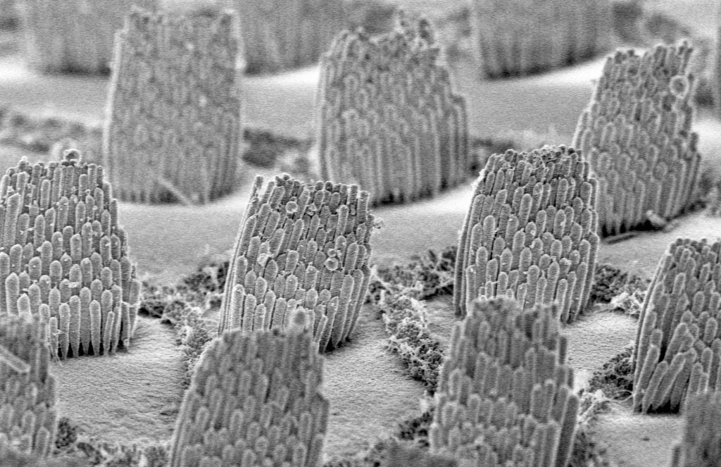 Inside the inner ear, the microscopic tips of hair cells look (kind of) like bunches of hair—thus the name. Over time, hair cells can get damaged or destroyed by loud noises and other traumas—and they won’t grow back. That means permanently losing some—or even all—hearing. But scientists have discovered certain animals (such as chickens) CAN regrow hair cells. This view through a scanning electron microscope shows the hair cells of a chicken blown up thousands of times. Scientists are studying these animals’ ears to see if there is a way to help people re-grow hair cells too.  (Inside the inner ear, the microscopic tips of hair cells look (kind of) like bunches of hair—thus the name. Over time, hair cells can get damaged or destroyed by loud noises and other traumas—and they won’t grow back. That means permanently losing some—or even all—hearing. But scientists have discovered certain animals (such as chickens) CAN regrow hair cells. This view through a scanning electron microscope shows the hair cells of a chicken blown up thousands of times. Scientists are studying these animals’ ears to see if there is a way to help people re-grow hair cells too. (Peter Gillespie via Cell Image Library) 